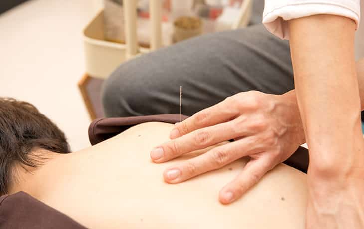 鍼灸で回復力を向上させ 総合的に改善へ導きます