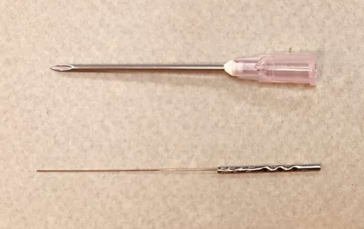 先端の丸みで痛みが伴いにくい鍼